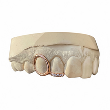 Load image into Gallery viewer, JORJA DIAMONDS GRILLZ