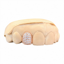 Load image into Gallery viewer, DIAMONDS GRILLZ