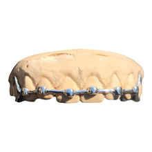 Load image into Gallery viewer, BRACES GRILLZ
