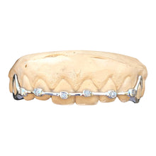 Load image into Gallery viewer, BRACES GRILLZ